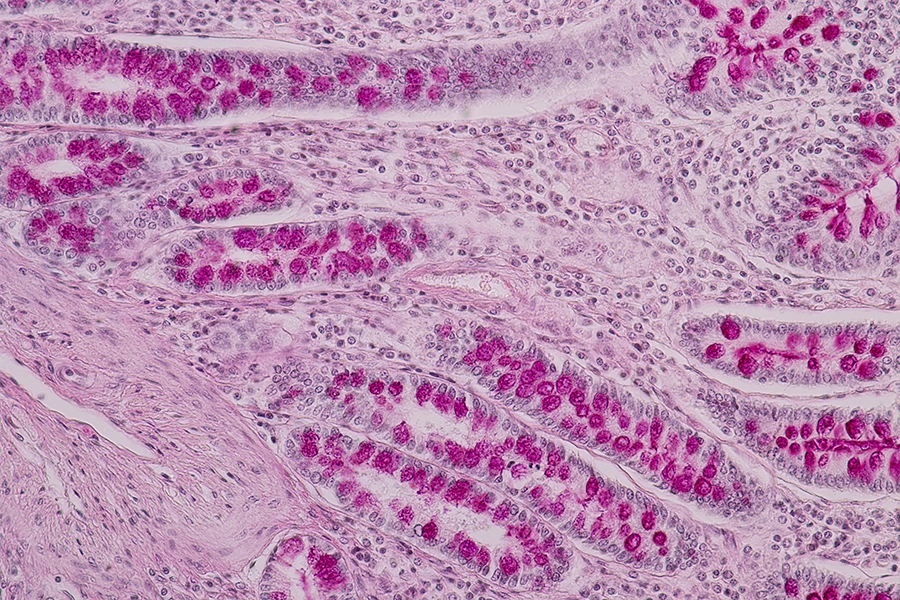 Small intestine or tissue of the small intestine under the microscope